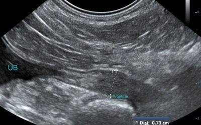 A Proficient Prostate Protocol