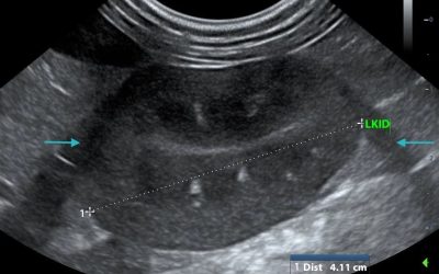 Pathology or Artifact?