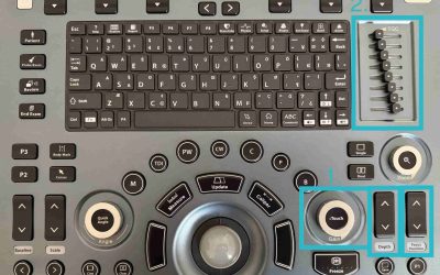 Ultrasound Knobology