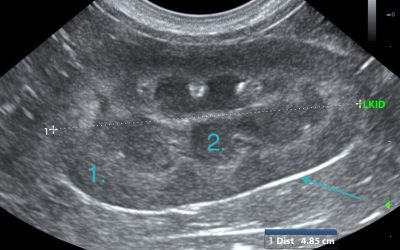 Veterinary Ultrasound Renal Anatomy